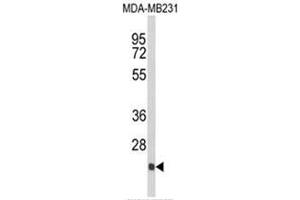 Image no. 1 for anti-Der1-Like Domain Family, Member 2 (DERL2) (C-Term) antibody (ABIN453619)