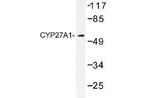 Image no. 1 for anti-Cytochrome P450, Family 27, Subfamily A, Polypeptide 1 (CYP27A1) antibody (ABIN272272)