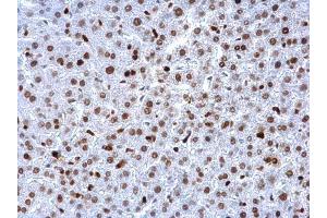 Image no. 9 for anti-Proliferating Cell Nuclear Antigen (PCNA) (Center) antibody (ABIN2854788)