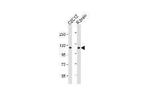 Image no. 4 for anti-Hexokinase 1 (HK1) (AA 78-108), (N-Term) antibody (ABIN392759)