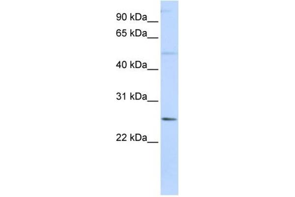 anti-Ferritin, Heavy Polypeptide-Like 17 (FTHL17) (N-Term) antibody