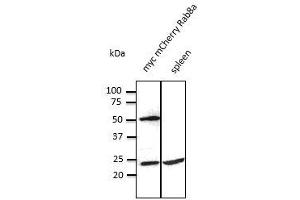Image no. 2 for anti-RAB8A, Member RAS Oncogene Family (RAB8A) (C-Term) antibody (ABIN6254181)