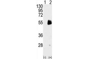 Image no. 2 for anti-Protein Arginine Methyltransferase 7 (PRMT7) (AA 660-692) antibody (ABIN3032365)