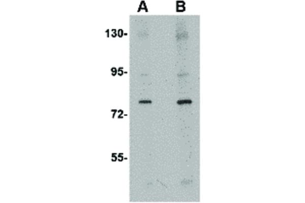 CRMP1 antibody  (N-Term)