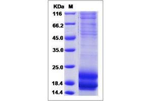 Image no. 1 for Calcitonin-Related Polypeptide alpha (CALCA) (AA 1-141) protein (His tag) (ABIN2215217)