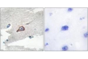 Image no. 1 for anti-Hemopoietic Cell Kinase (HCK) (AA 381-430) antibody (ABIN1532620)