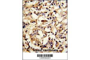 Immunohistochemistry (IHC) image for anti-Deafness, Autosomal Dominant 5 (DFNA5) antibody (ABIN2158536)