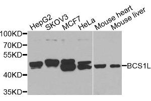 Image no. 1 for anti-BCS1-Like (BCS1L) antibody (ABIN6137520)