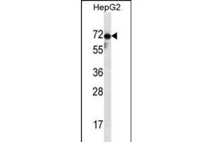 ZP1 antibody  (C-Term)