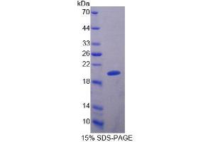 Image no. 1 for Slit Homolog 2 (Drosophila) (SLIT2) (AA 209-374) protein (His tag) (ABIN1171386)