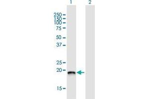 Image no. 1 for anti-DCTP Pyrophosphatase 1 (DCTPP1) (AA 1-170) antibody (ABIN2565480)
