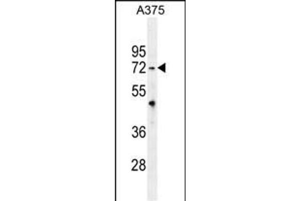 TRIM56 抗体  (C-Term)