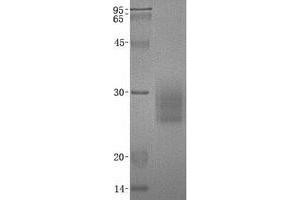 Image no. 1 for Natural Cytotoxicity Triggering Receptor 3 (NCR3) (Transcript Variant 2) protein (His tag) (ABIN2713677)