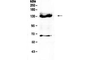 Image no. 2 for anti-Fms-Related tyrosine Kinase 3 (FLT3) (AA 61-294) antibody (ABIN5518987)
