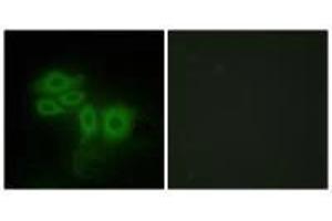 Immunofluorescence analysis of HepG2 cells, using SLK antibody.