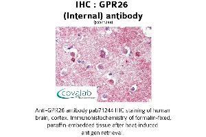 Image no. 1 for anti-G Protein-Coupled Receptor 26 (GPR26) (Internal Region) antibody (ABIN1735038)