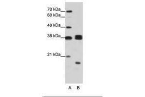 Image no. 2 for anti-Heterogeneous Nuclear Ribonucleoprotein H3 (2H9) (HNRNPH3) (AA 51-100) antibody (ABIN203064)