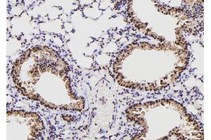 Image no. 2 for anti-Male Germ Cell-Associated Kinase (MAK) (pThr1579) antibody (ABIN6269927)