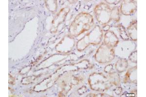 Formalin-fixed and paraffin embedded human kidney labeled with Rabbit Anti-IL-31 Polyclonal Antibody, Unconjugated  at 1:200 followed by conjugation to the secondary antibody and DAB staining