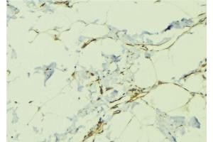 Image no. 2 for anti-Teratocarcinoma-Derived Growth Factor 1 (TDGF1) (Internal Region) antibody (ABIN6265513)