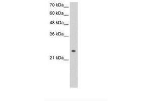 Image no. 1 for anti-Alcohol Dehydrogenase 6 (Class V) (ADH6) (AA 215-264) antibody (ABIN203376)