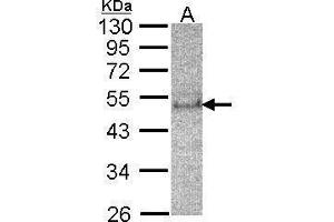 Image no. 2 for anti-Suppressor of Cytokine Signaling 4 (SOCS4) (C-Term) antibody (ABIN2855920)
