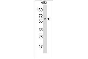 Image no. 1 for anti-Glypican 6 (GPC6) (N-Term) antibody (ABIN358978)