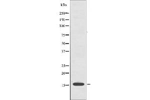 Image no. 1 for anti-Cytochrome B5 Type A (Microsomal) (CYB5A) (Internal Region) antibody (ABIN6259625)