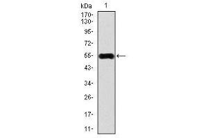 Image no. 2 for anti-Calcium/calmodulin-Dependent Protein Kinase IV (CAMK4) antibody (ABIN1491438)