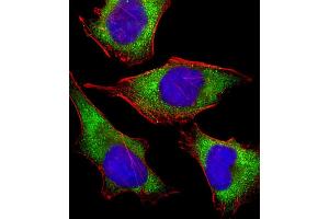 Image no. 8 for anti-MHC Class I Polypeptide-Related Sequence A (MICA) (AA 68-97) antibody (ABIN652566)