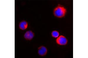 Image no. 2 for anti-Proteinase 3 (PRTN3) (C-Term) antibody (ABIN350763)