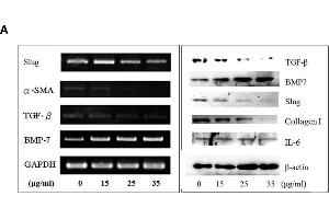 Image no. 9 for anti-Actin, alpha 2, Smooth Muscle, Aorta (ACTA2) (N-Term) antibody (ABIN2857027)