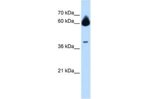 Image no. 1 for anti-Matrix Metallopeptidase 23B (MMP23B) antibody (ABIN2463013)