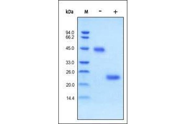 VEGF Protein (Vascular Endothelial Growth Factor) (AA 27-191)