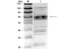 anti-Regulatory Factor X 5 (RFX5) (AA 32-0) antibody