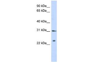Image no. 1 for anti-Synovial Sarcoma, X Breakpoint 5 (SSX5) (Middle Region) antibody (ABIN2774973)