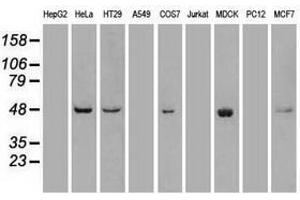Image no. 3 for anti-Polo-Like Kinase 1 (PLK1) antibody (ABIN1500279)