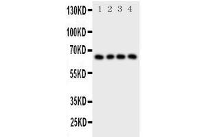 Image no. 1 for anti-Parathyroid Hormone 1 Receptor (PTH1R) (AA 388-406), (C-Term) antibody (ABIN3043983)