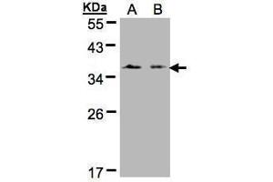 Image no. 1 for anti-Secreted Frizzled-Related Protein 1 (SFRP1) (Center) antibody (ABIN2855373)