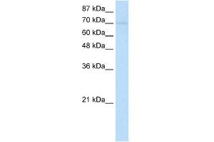 Image no. 1 for anti-Zinc Finger Protein 282 (ZNF282) (N-Term) antibody (ABIN2780534)
