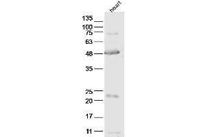 anti-ABI Family, Member 3 (ABI3) (AA 151-250) antibody
