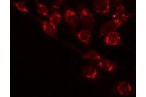 Image no. 1 for anti-Betacellulin (BTC) antibody (ABIN6260321)