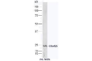 anti-Chromosome 6 Open Reading Frame 25 (C6orf25) (AA 1-100) antibody