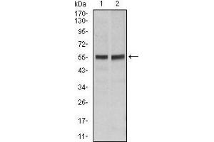 Image no. 1 for anti-TNF Receptor Superfamily, Member 6 (FAS) antibody (ABIN969518)