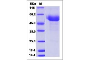 Image no. 1 for serine Peptidase Inhibitor, Kunitz Type, 2 (SPINT2) (AA 1-197) (Active) protein (Fc Tag,ECD) (ABIN2002567)