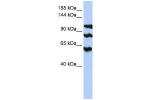 Image no. 1 for anti-Protein Phosphatase 1, Regulatory Subunit 13B (PPP1R13B) antibody (ABIN634596)