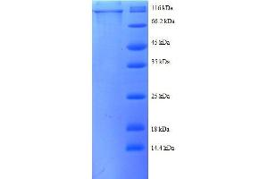Image no. 1 for Catenin (Cadherin-Associated Protein), beta 1, 88kDa (CTNNB1) (AA 2-781), (partial) protein (GST tag) (ABIN1607942)