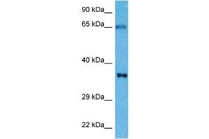 Image no. 2 for anti-Cardiac Troponin T (cTnT) (N-Term) antibody (ABIN2776953)