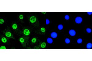 Image no. 5 for anti-Signal Transducer and Activator of Transcription 3 (Acute-Phase Response Factor) (STAT3) (pSer727) antibody (ABIN5557530)