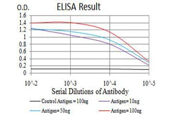 anti-Lysine (K)-Specific Demethylase 6A (KDM6A) (AA 1252-1401) antibody